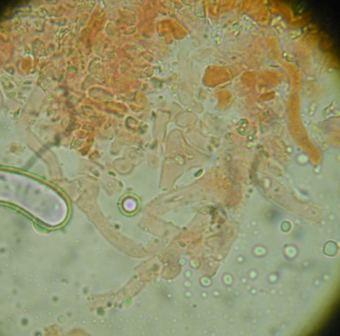 Pseudomerulius aureus? (Pseudomerulius aureus)