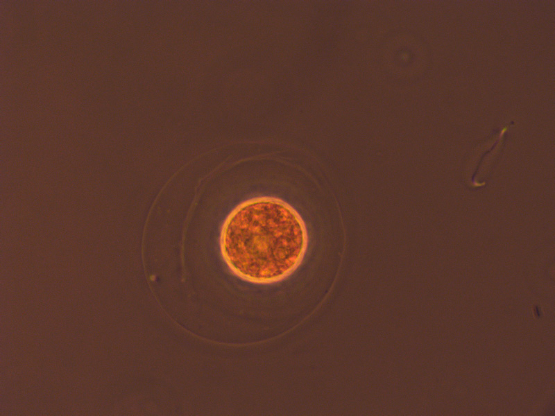 haematococcus? optika b5
