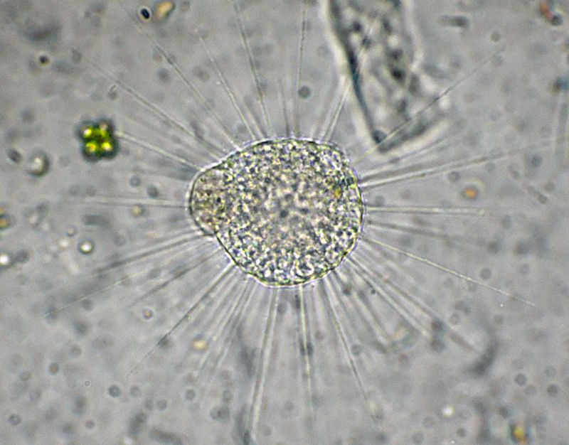 Eliozoi del genere Acanthocystis