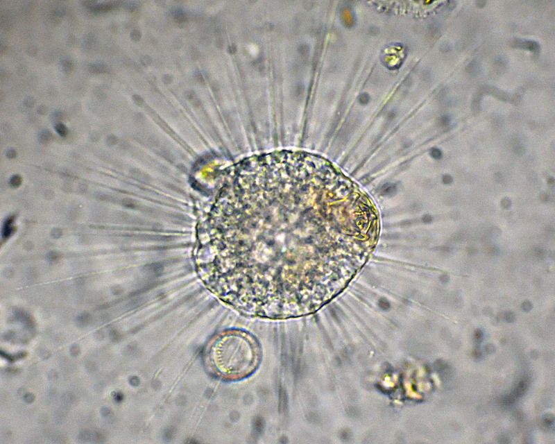 Eliozoi del genere Acanthocystis