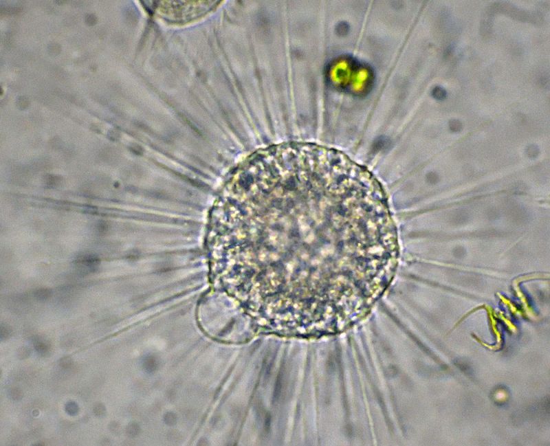 Eliozoi del genere Acanthocystis