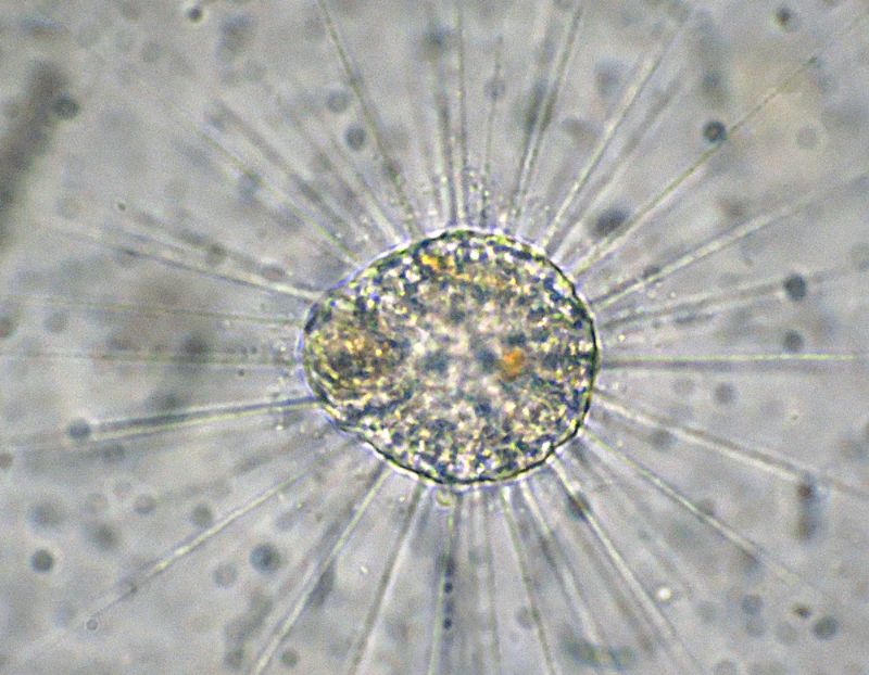 Eliozoi del genere Acanthocystis
