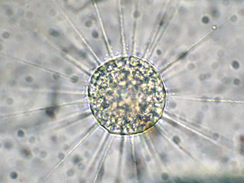 Eliozoi del genere Acanthocystis