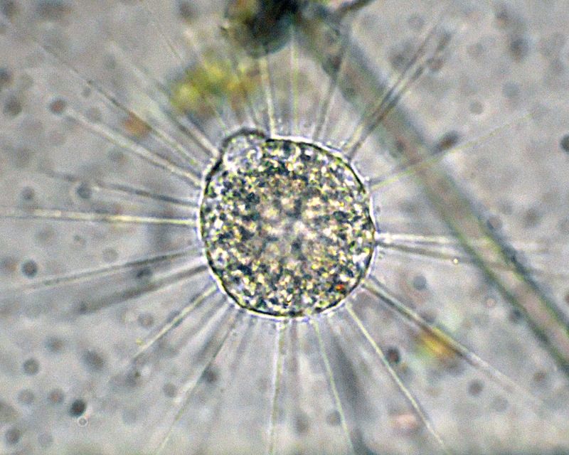 Eliozoi del genere Acanthocystis