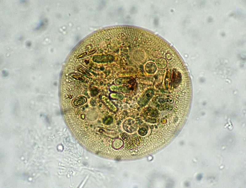 TECAMEBE A GO-GO!!  Arcella sp.