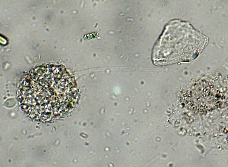 ANCORA ELIOZOI CLATHRULINA