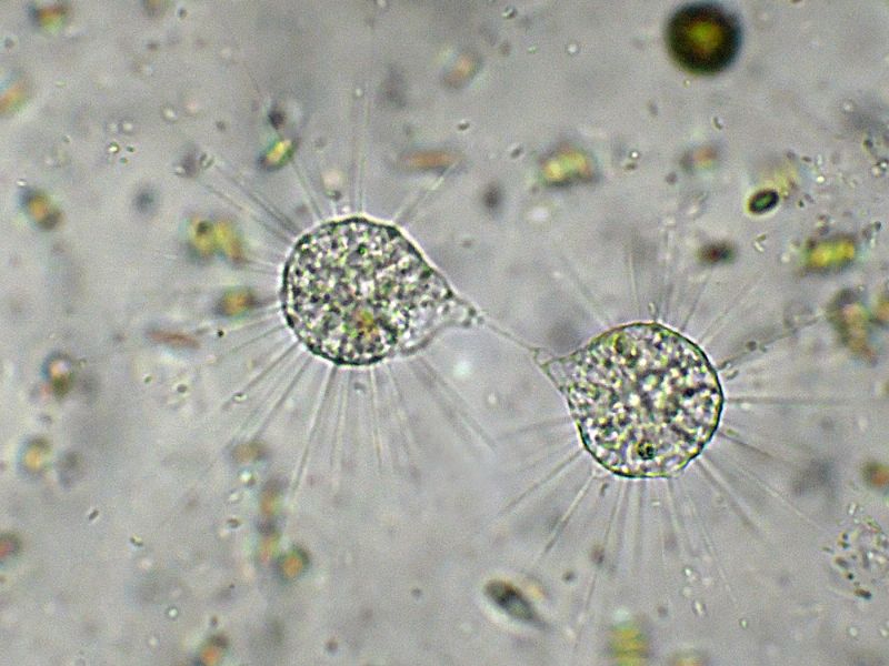 GRUPPO DI FAGOCITAZIONE