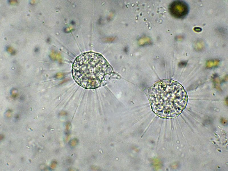 GRUPPO DI FAGOCITAZIONE