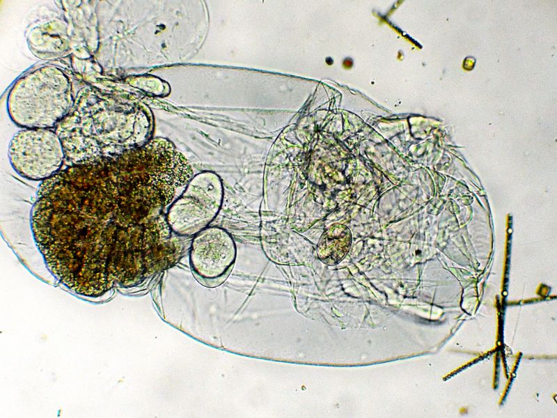 ASPLANCHNA-PRIODONTA (ROTIFERO)