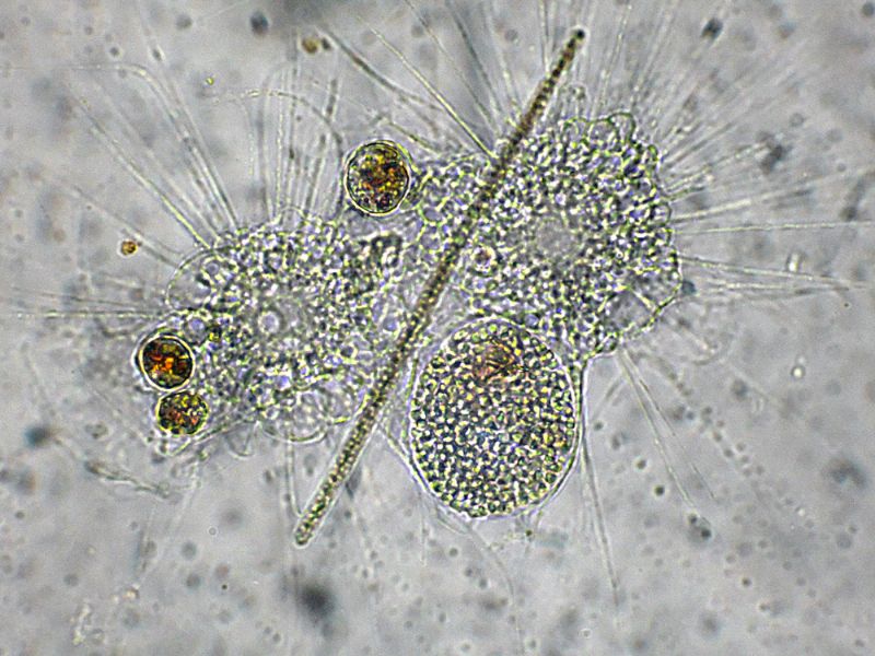 ANCORA GRUPPI DI FAGOCITAZIONE!!