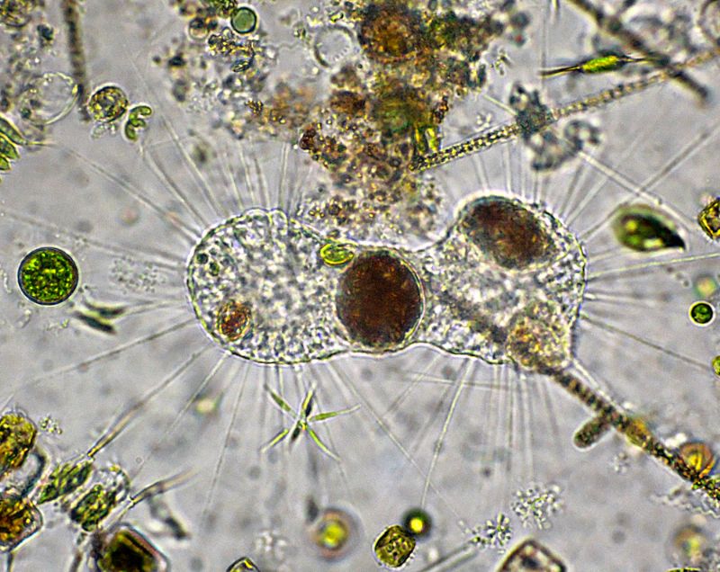 ANCORA GRUPPI DI FAGOCITAZIONE!!