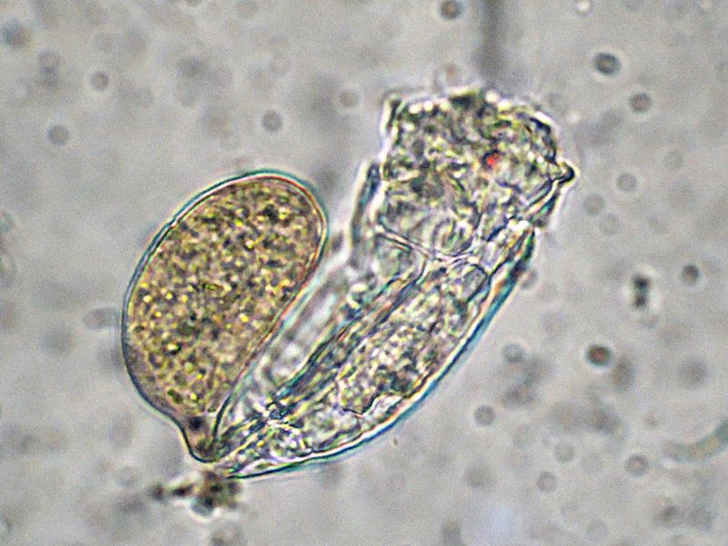 ROTIFERO DA IDENTIFICARE