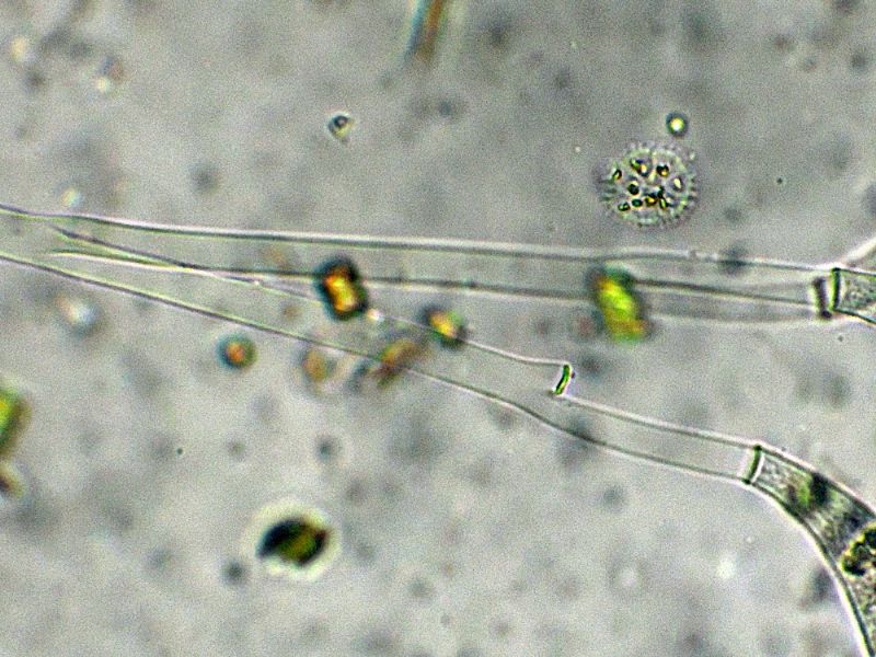 Epistylis-rotans