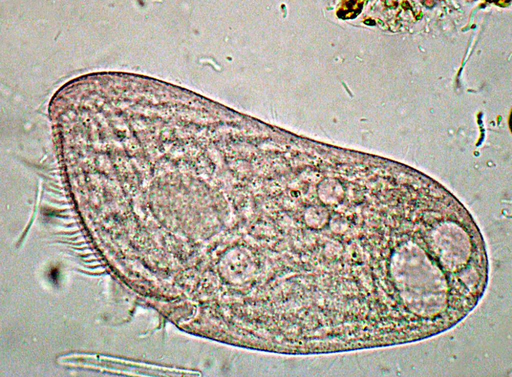 Blepharisma-lateritium