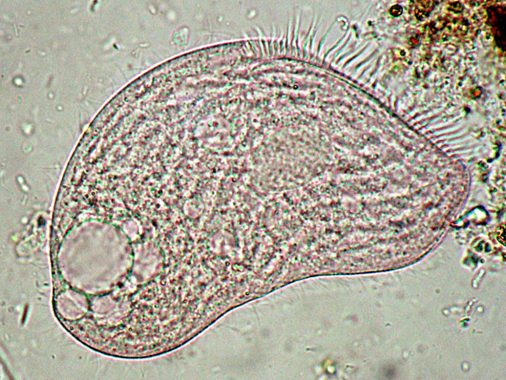 Blepharisma-lateritium