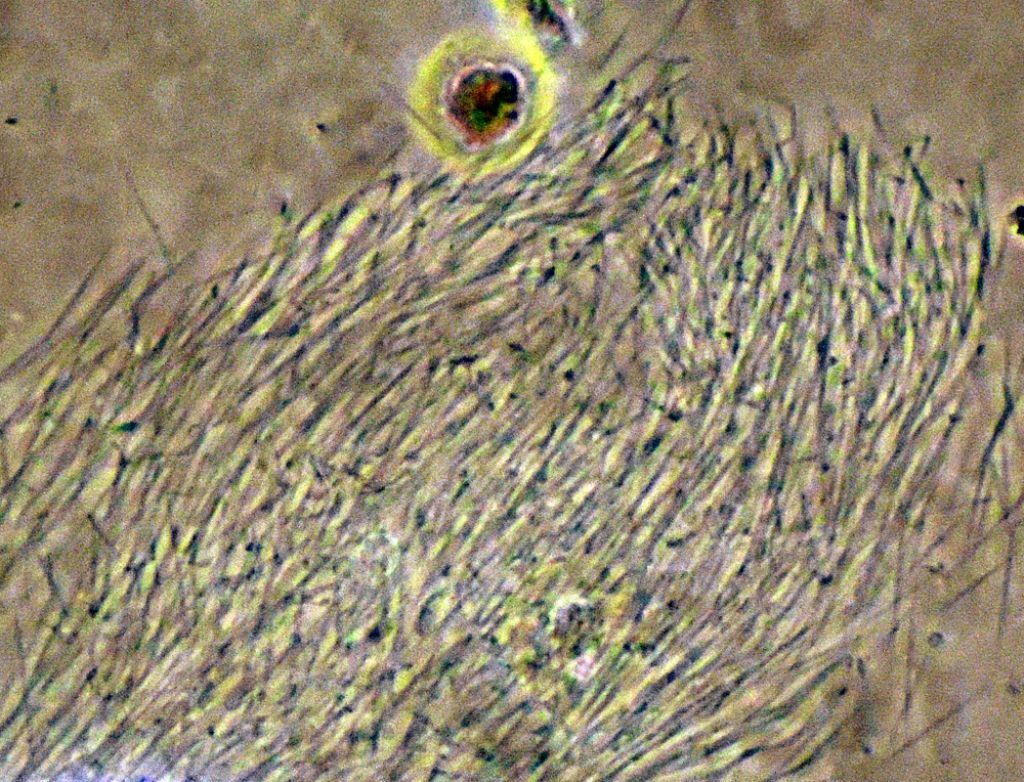 Paramecium-caudatum in cdf in coniugazioneed altro
