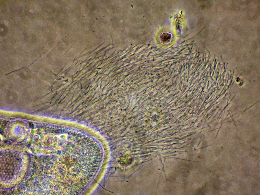 Paramecium-caudatum in cdf in coniugazioneed altro