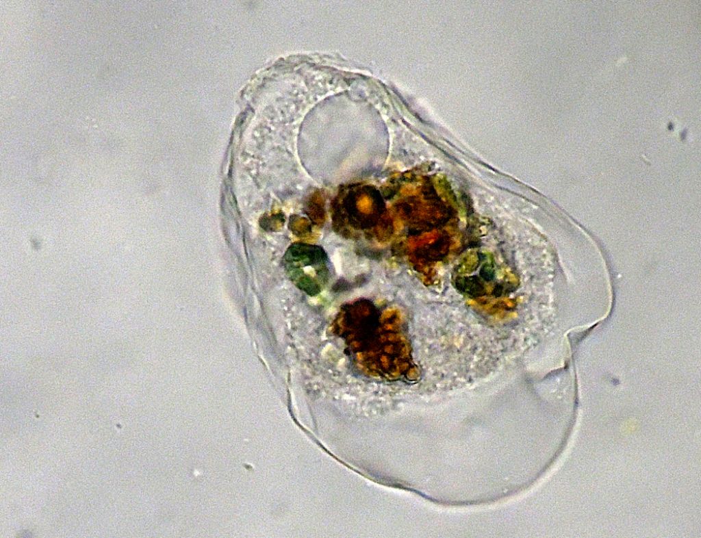 Thecamoeba-verrucosa o Amoeba-terricola