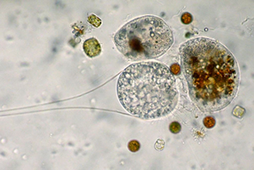 Metacineta