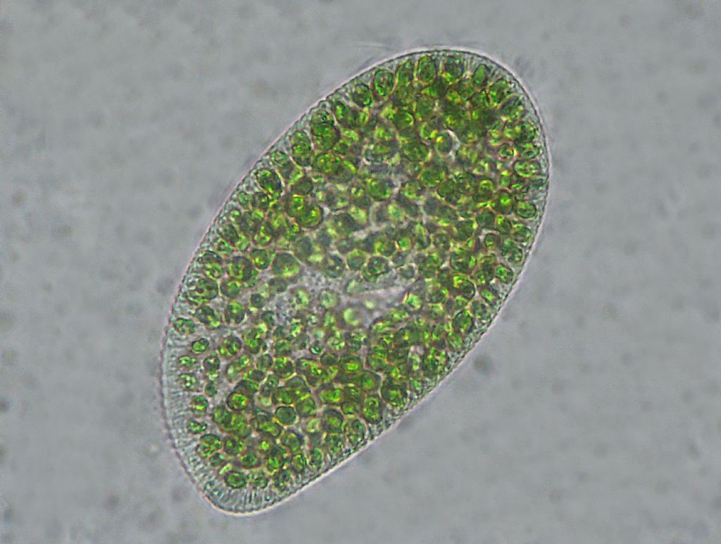 Paramecium-bursaria e Tecameba-Arcella