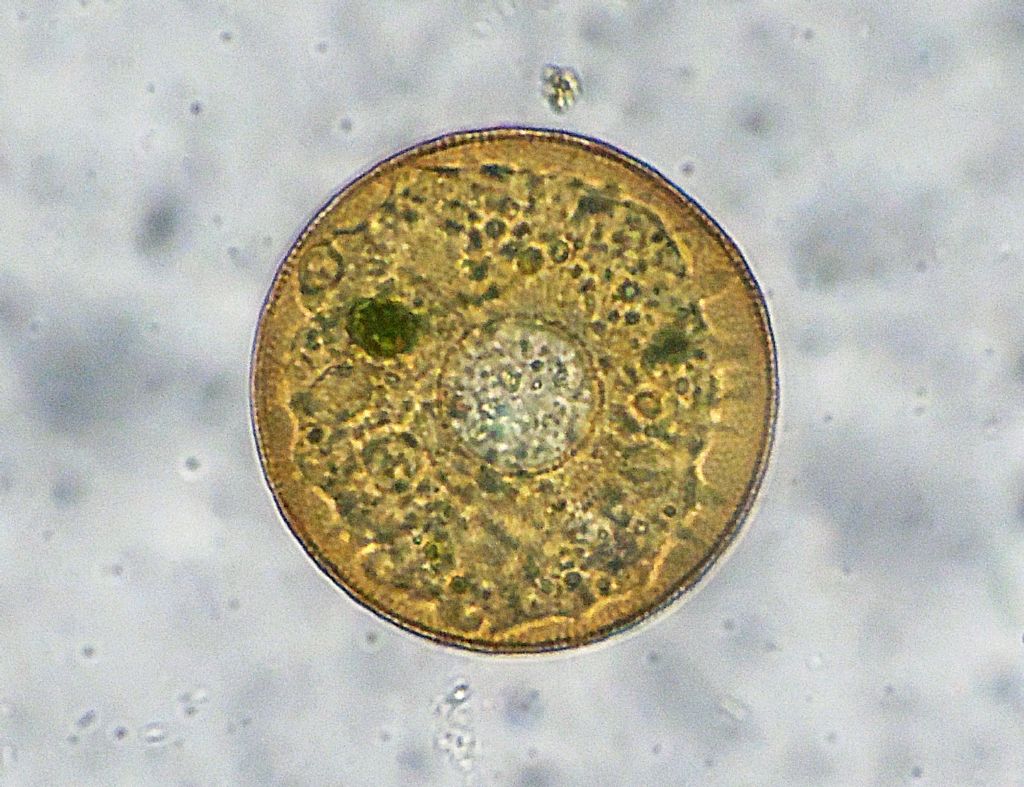 Paramecium-bursaria e Tecameba-Arcella