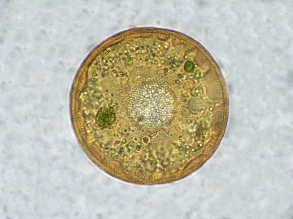 Paramecium-bursaria e Tecameba-Arcella