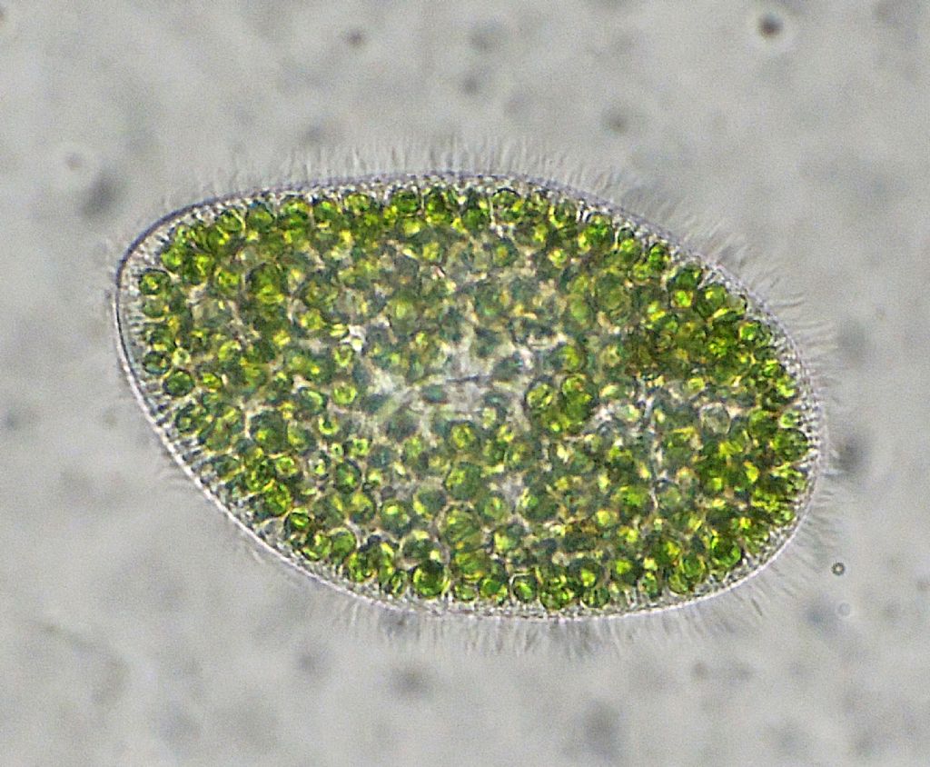 Paramecium-bursaria e Tecameba-Arcella