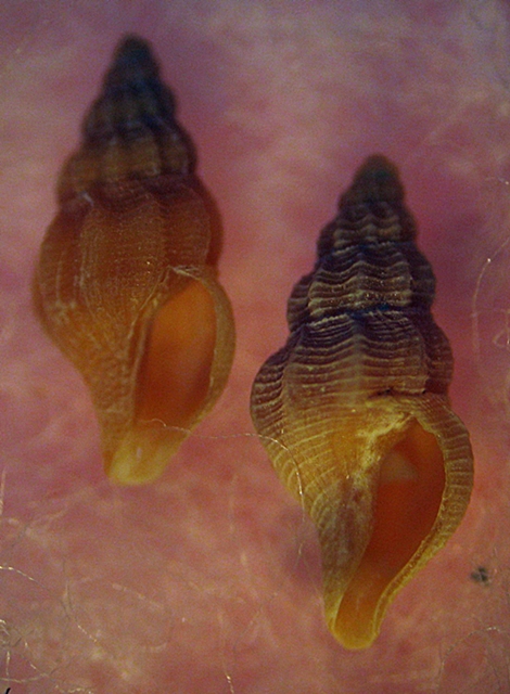 Gasteropodi in ripascimento alto Adriatico