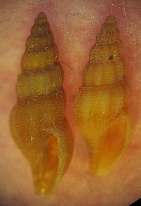 Gasteropodi in ripascimento alto Adriatico