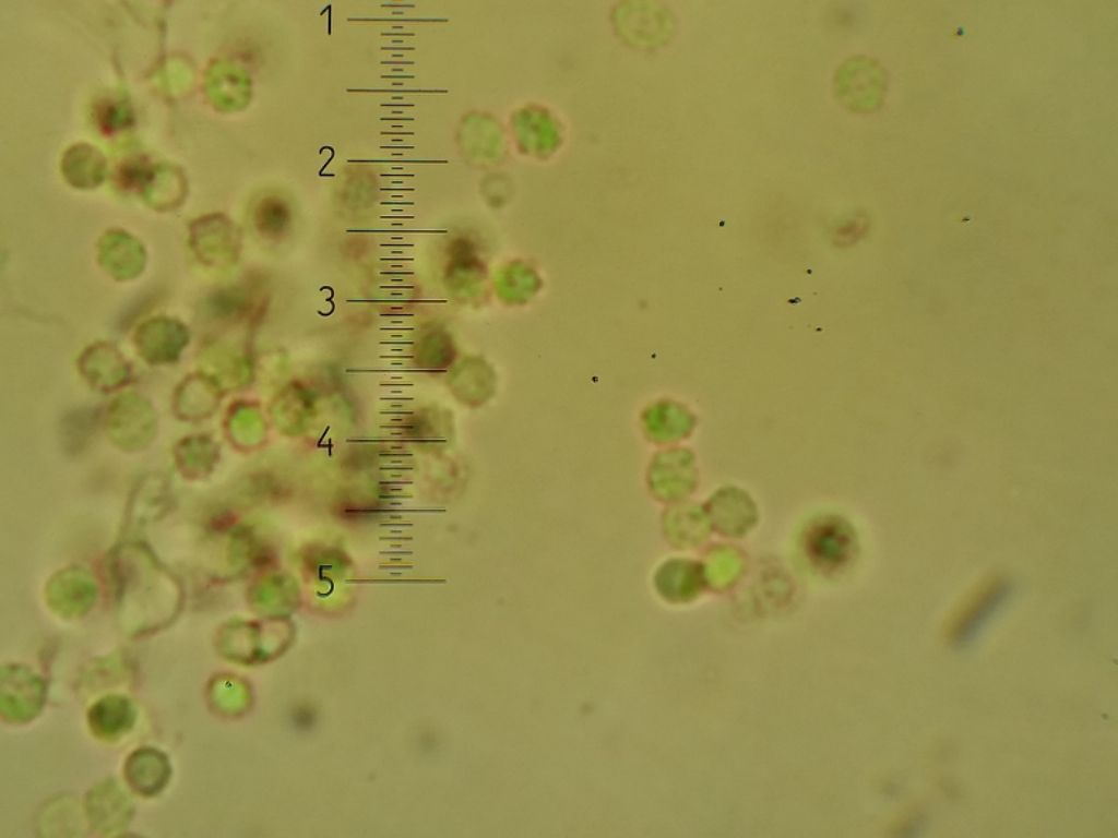 Trechispora farinacea