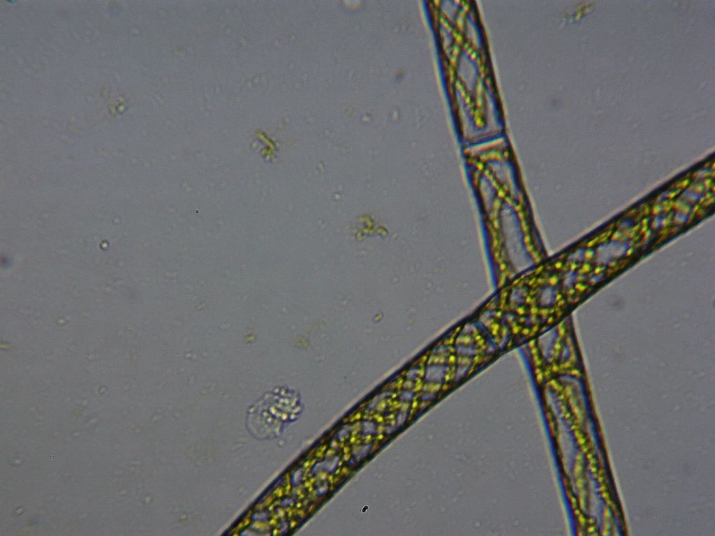 Spirogyra mirabilis?