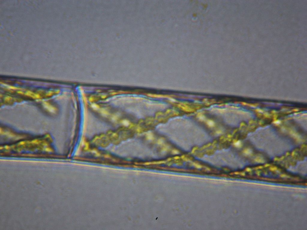 Spirogyra mirabilis?