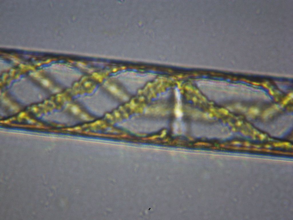 Spirogyra mirabilis?