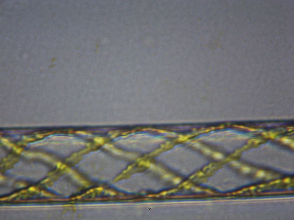 Spirogyra mirabilis?