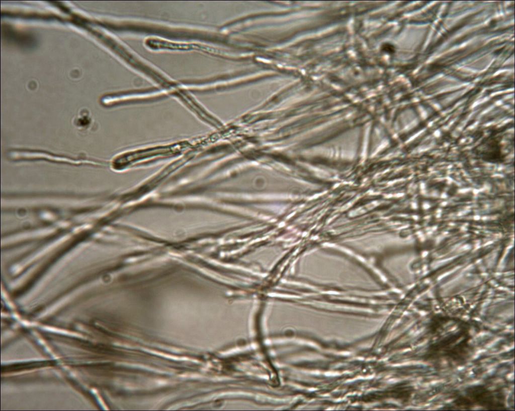 Corticium meridioroseum ?