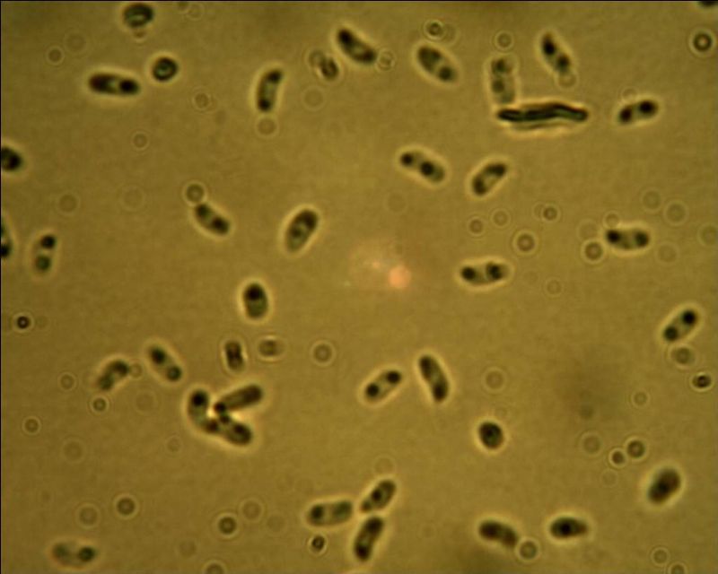 Phebia rufa? (Phlebia rufa)