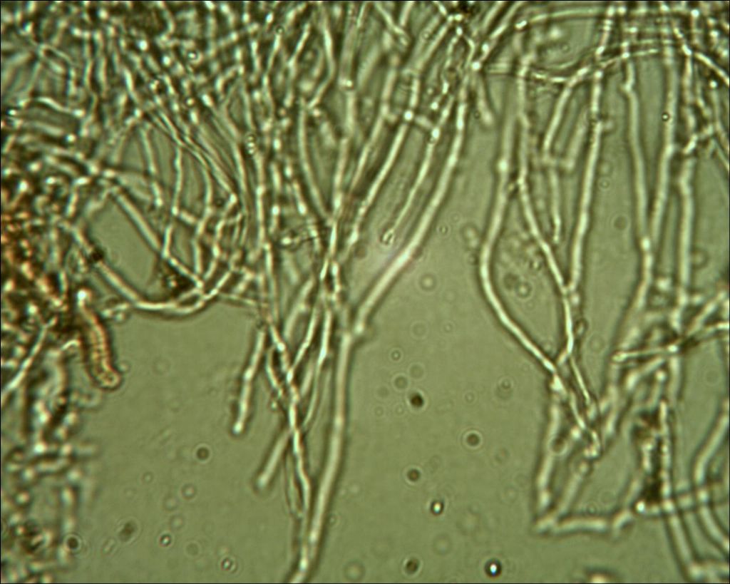 Corticium meridioroseum ?