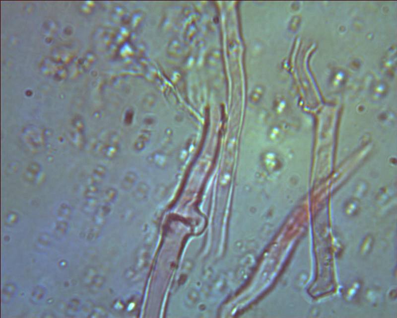 Rhizochaete radicata? (Rhizochaete radicata)