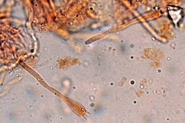 Gloeocystidiellum karstenii? (Laxitextum bicolor)