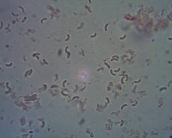 Oligoporus?? (Skeletocutis amorpha)