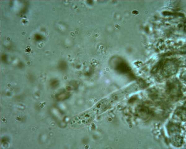 Phlebia tremellosa?