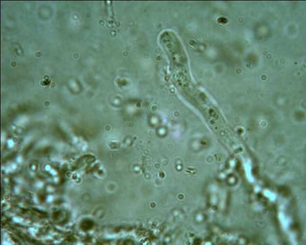 Phlebia tremellosa?