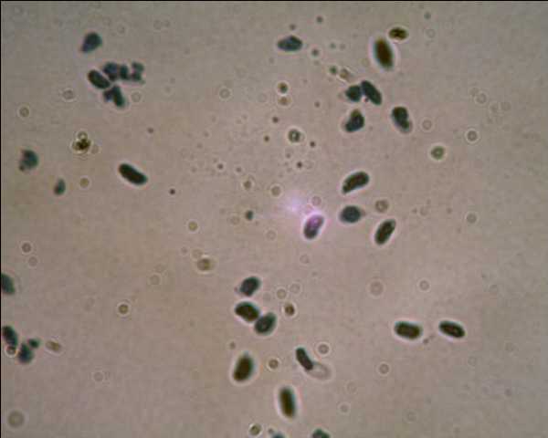 Phlebia tremellosa?