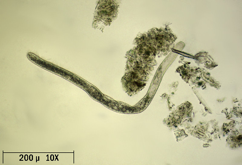 Spirostomum sp.