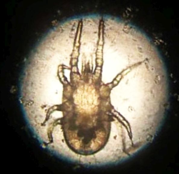 Mesostigmata Macronyssidae: Dermanyssus gallinae