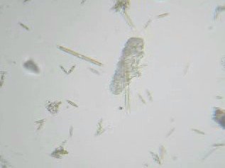 Tardigrado