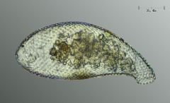 Cyphoderiidae