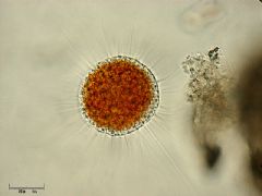 Vampyrellidae