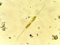 Nitzschia sp.