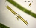 Nitzschia sigmoide
